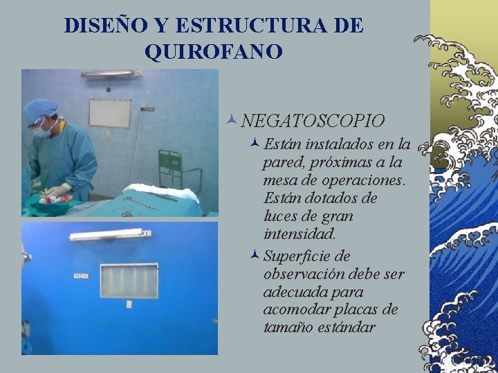 DISEÑO Y ESTRUCTURA DE QUIROFANO © NEGATOSCOPIO ©Están instalados en la pared, próximas a