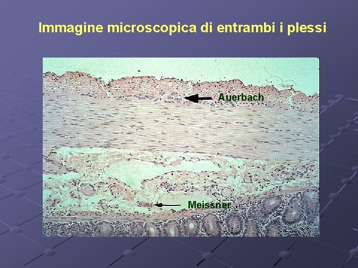 Immagine microscopica di entrambi i plessi Auerbach Meissner 