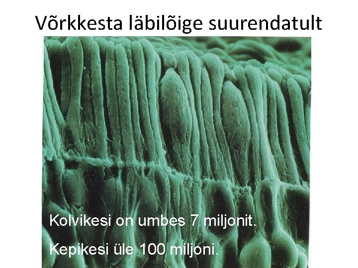 Võrkkesta läbilõige suurendatult Kolvikesi on umbes 7 miljonit. Kepikesi üle 100 miljoni. Enn Pärtel