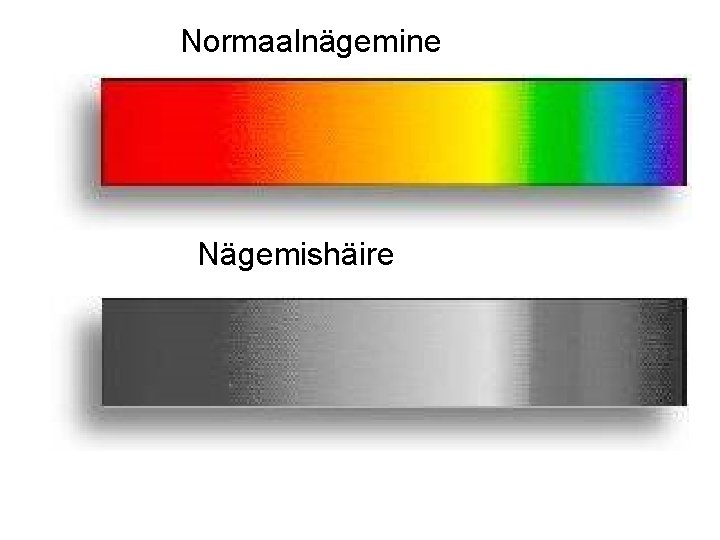 Normaalnägemine Nägemishäire 