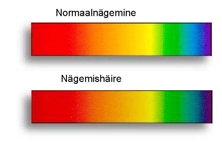 Normaalnägemine Nägemishäire 