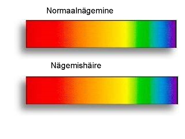Normaalnägemine Nägemishäire 