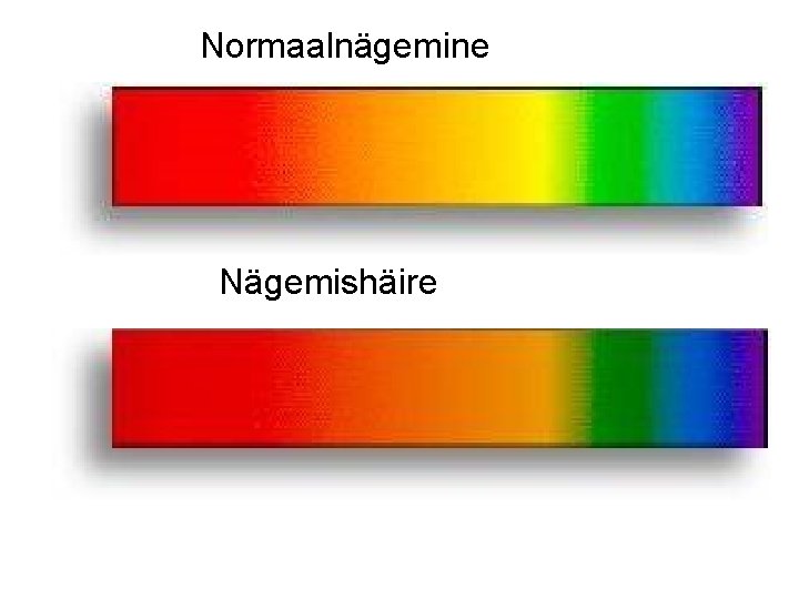 Normaalnägemine Nägemishäire 