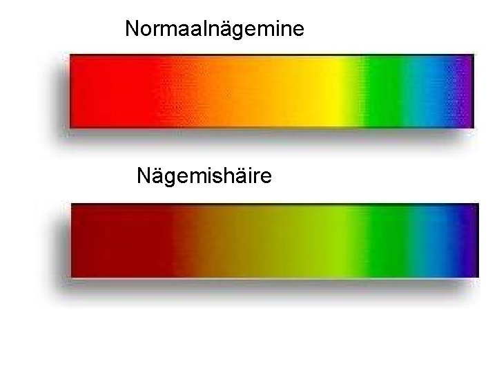 Normaalnägemine Nägemishäire 