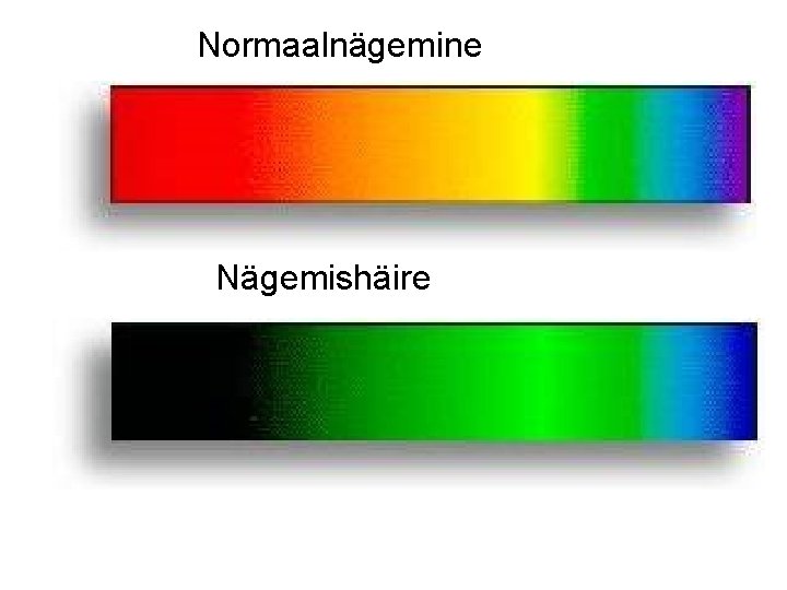 Normaalnägemine Nägemishäire 