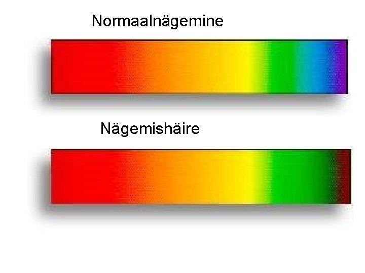 Normaalnägemine Nägemishäire 
