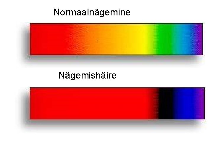 Normaalnägemine Nägemishäire 