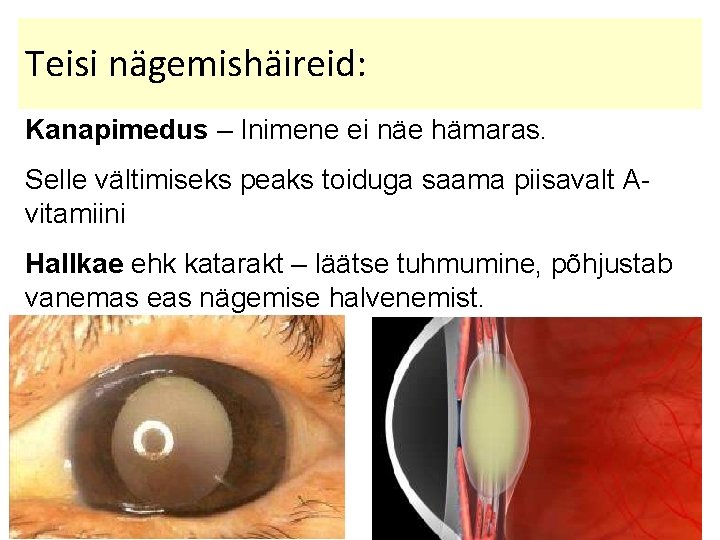 Teisi nägemishäireid: Kanapimedus – Inimene ei näe hämaras. Selle vältimiseks peaks toiduga saama piisavalt