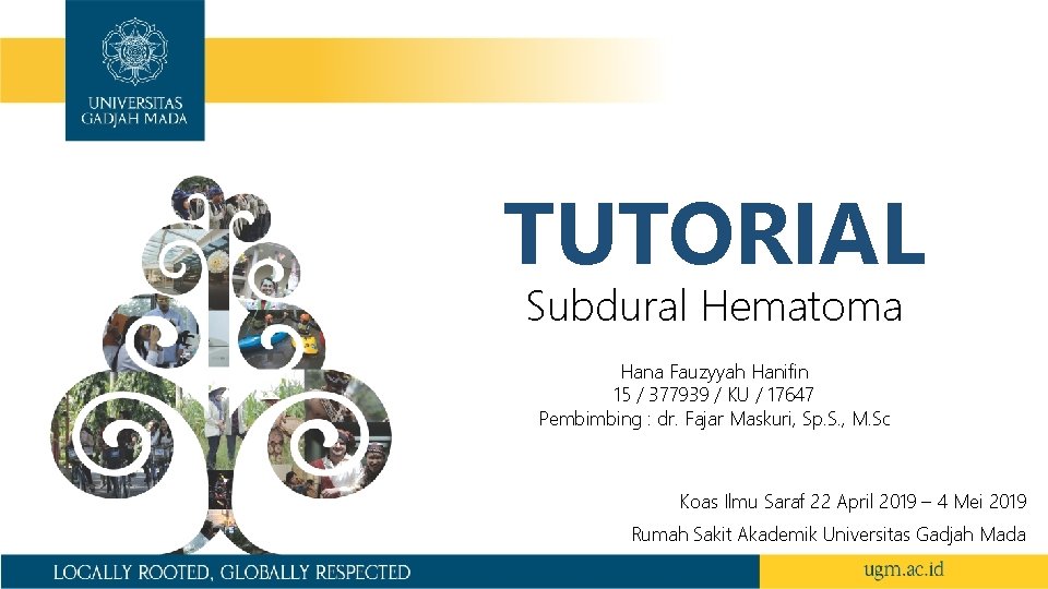 TUTORIAL Subdural Hematoma Hana Fauzyyah Hanifin 15 / 377939 / KU / 17647 Pembimbing