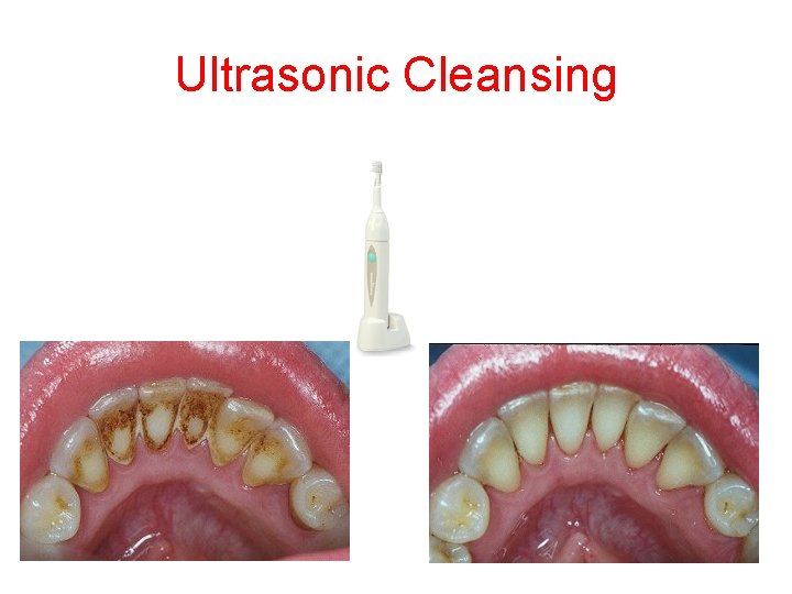 Ultrasonic Cleansing Ultrasonic Cleansing