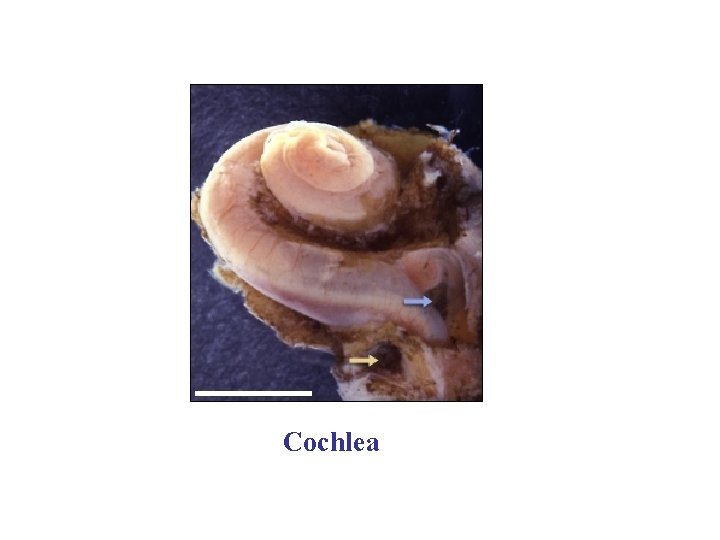 Cochlea Cochlea