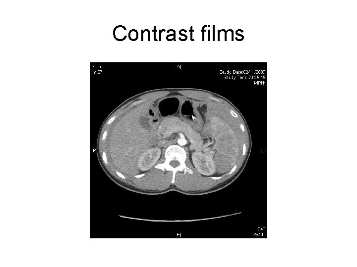 Contrast films 