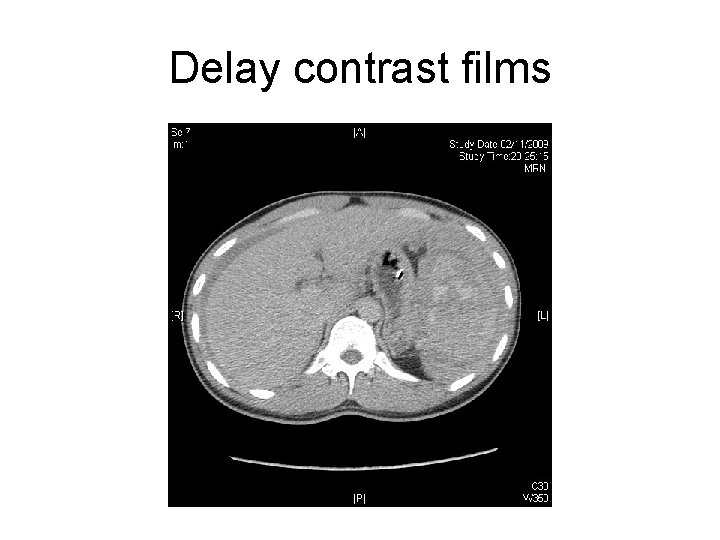 Delay contrast films 