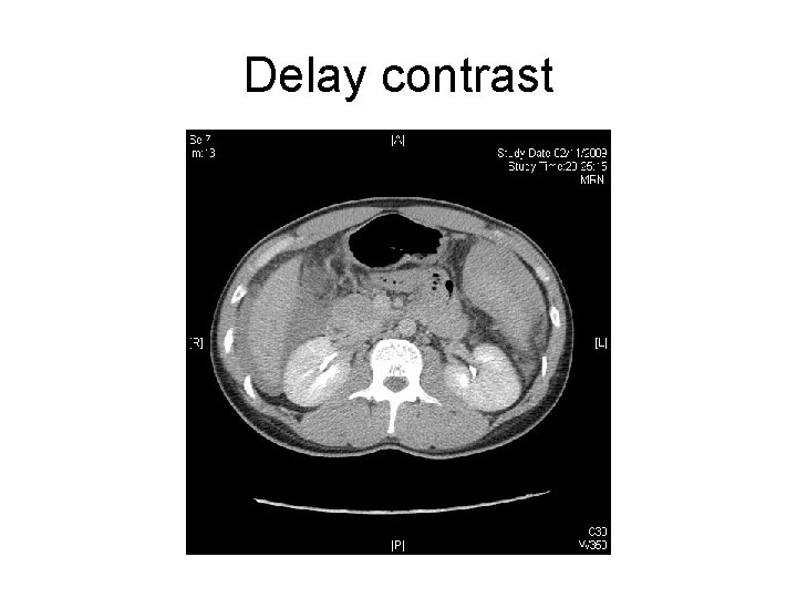 Delay contrast 