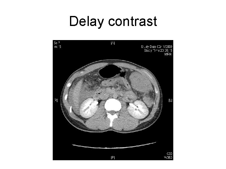 Delay contrast 