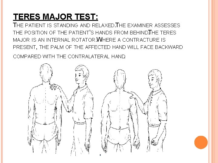 TERES MAJOR TEST: THE PATIENT IS STANDING AND RELAXED. THE EXAMINER ASSESSES THE POSITION