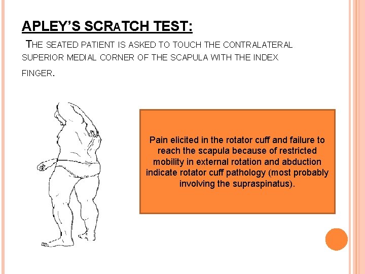 APLEY’S SCRATCH TEST: THE SEATED PATIENT IS ASKED TO TOUCH THE CONTRALATERAL SUPERIOR MEDIAL