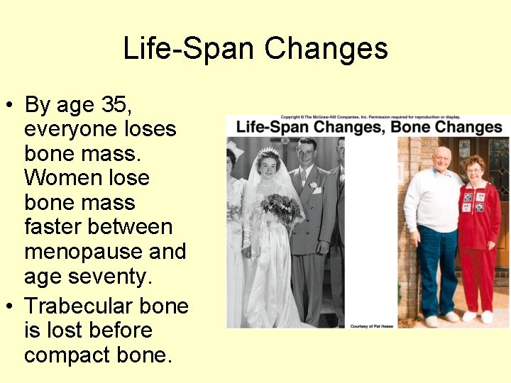 Life-Span Changes • By age 35, everyone loses bone mass. Women lose bone mass