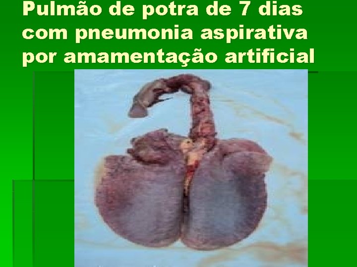 Pulmão de potra de 7 dias com pneumonia aspirativa por amamentação artificial 