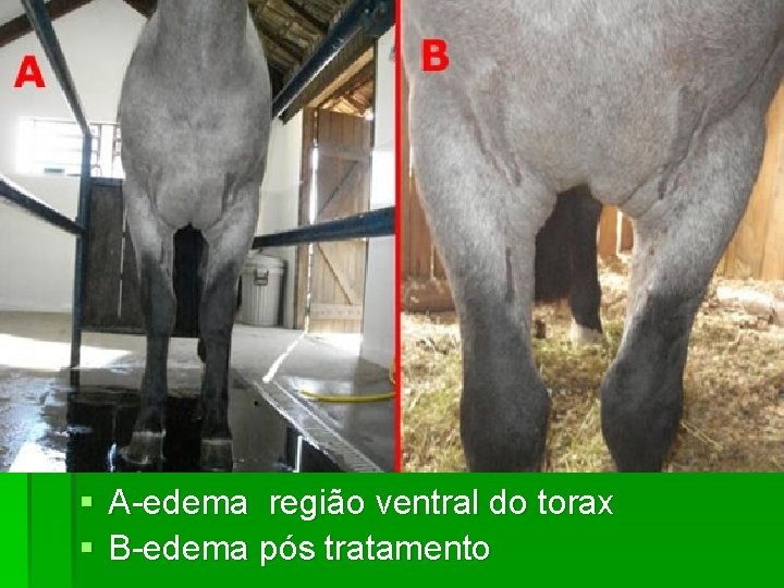 § A-edema região ventral do torax § B-edema pós tratamento 