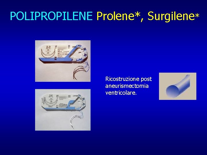 POLIPROPILENE Prolene*, Surgilene* Ricostruzione post aneurismectomia ventricolare. 