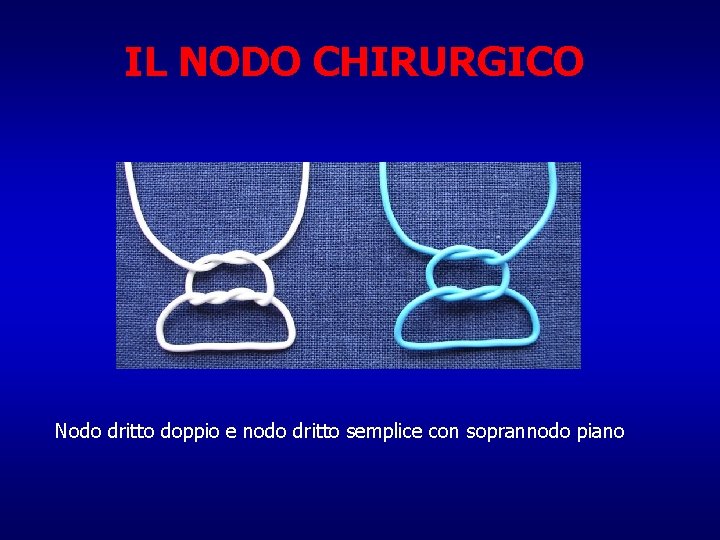 IL NODO CHIRURGICO Nodo dritto doppio e nodo dritto semplice con soprannodo piano 