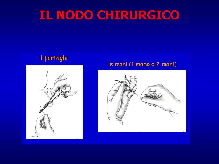 IL NODO CHIRURGICO 