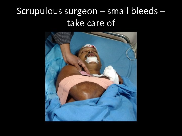 Scrupulous surgeon – small bleeds – take care of 