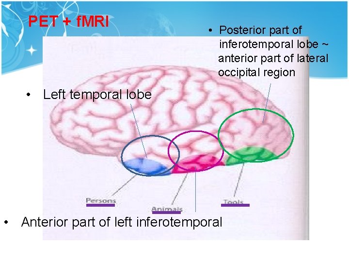 PET + f. MRI • Posterior part of inferotemporal lobe ~ anterior part of PET + f. MRI • Posterior part of inferotemporal lobe ~ anterior part of