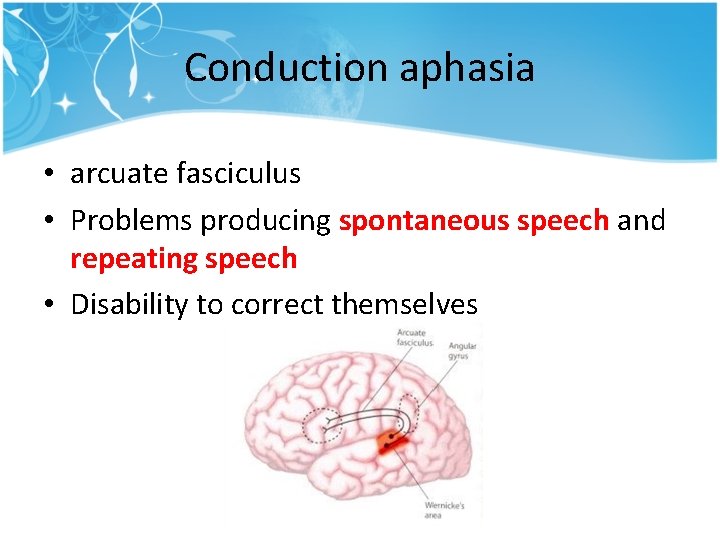 Conduction aphasia • arcuate fasciculus • Problems producing spontaneous speech and repeating speech • Conduction aphasia • arcuate fasciculus • Problems producing spontaneous speech and repeating speech •