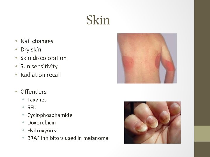 Skin • • • Nail changes Dry skin Skin discoloration Sun sensitivity Radiation recall