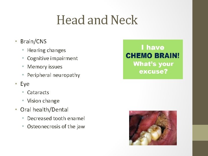 Head and Neck • Brain/CNS • • Hearing changes Cognitive impairment Memory issues Peripheral