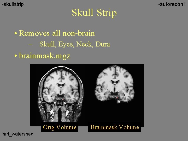 -skullstrip Skull Strip • Removes all non-brain – Skull, Eyes, Neck, Dura • brainmask.