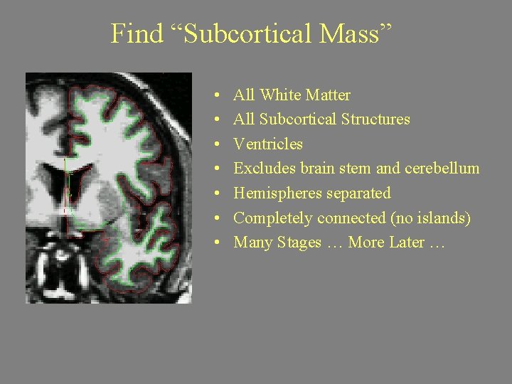 Find “Subcortical Mass” • • All White Matter All Subcortical Structures Ventricles Excludes brain