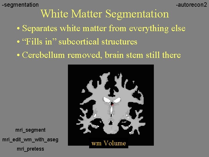 -segmentation White Matter Segmentation -autorecon 2 • Separates white matter from everything else •