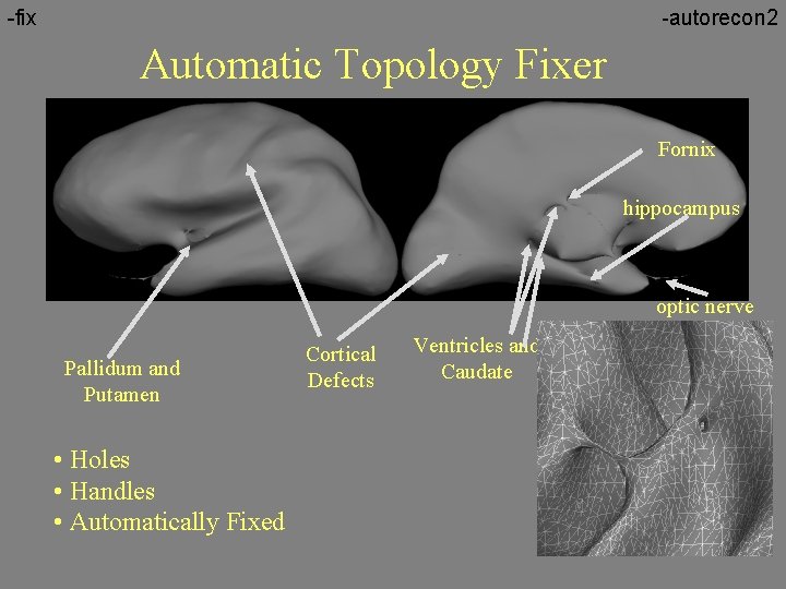 -fix -autorecon 2 Automatic Topology Fixer Fornix hippocampus optic nerve Pallidum and Putamen •
