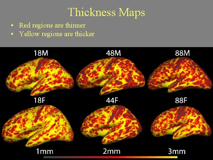 Thickness Maps • Red regions are thinner • Yellow regions are thicker 