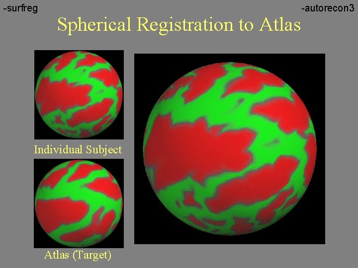 -surfreg Spherical Registration to Atlas Individual Subject Atlas (Target) -autorecon 3 