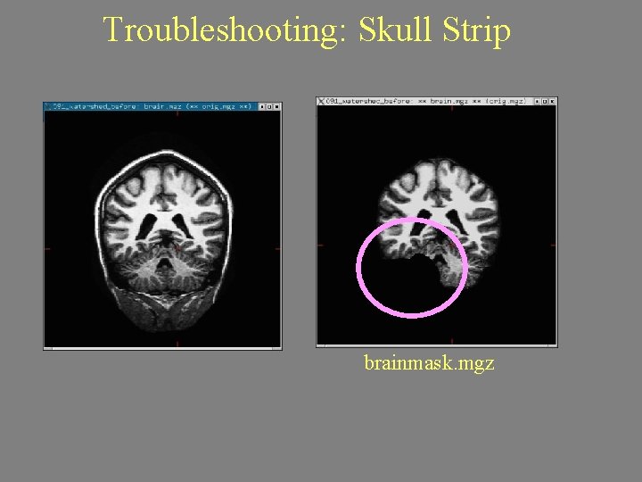 Troubleshooting: Skull Strip brainmask. mgz 