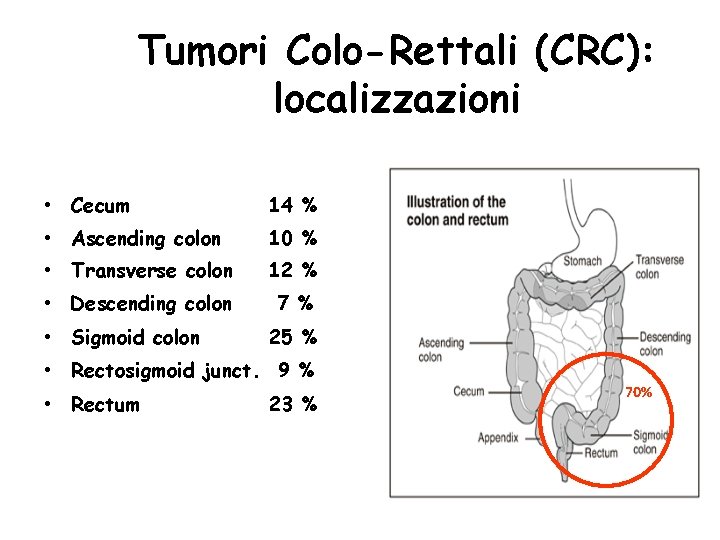 Tumori Colo-Rettali (CRC): localizzazioni • Cecum 14 % • Ascending colon 10 % • Tumori Colo-Rettali (CRC): localizzazioni • Cecum 14 % • Ascending colon 10 % •