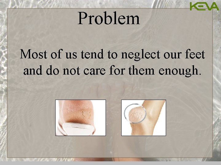 Problem Most of us tend to neglect our feet and do not care for