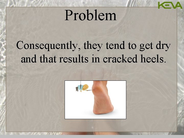 Problem Consequently, they tend to get dry and that results in cracked heels. 