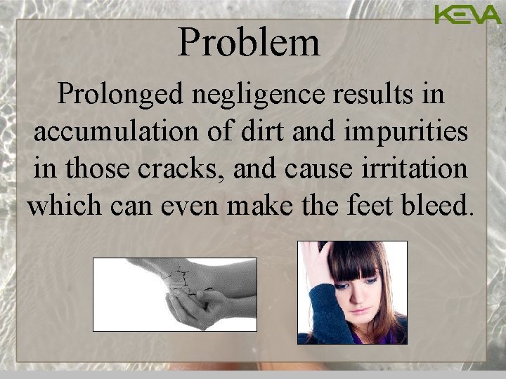Problem Prolonged negligence results in accumulation of dirt and impurities in those cracks, and