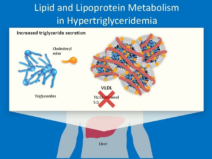 Lipid and Lipoprotein Metabolism in Hypertriglyceridemia Increased triglyceride secretion Cholesteryl ester VLDL Triglycerides TG: