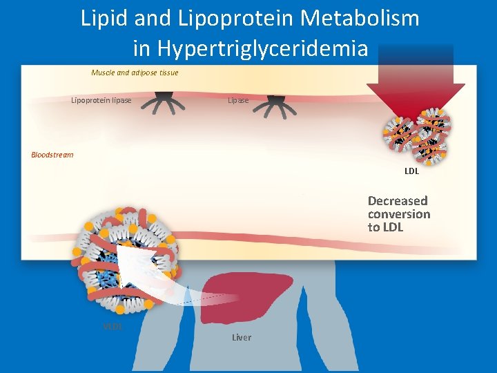 Lipid and Lipoprotein Metabolism in Hypertriglyceridemia Muscle and adipose tissue Lipoprotein lipase Lipase Bloodstream