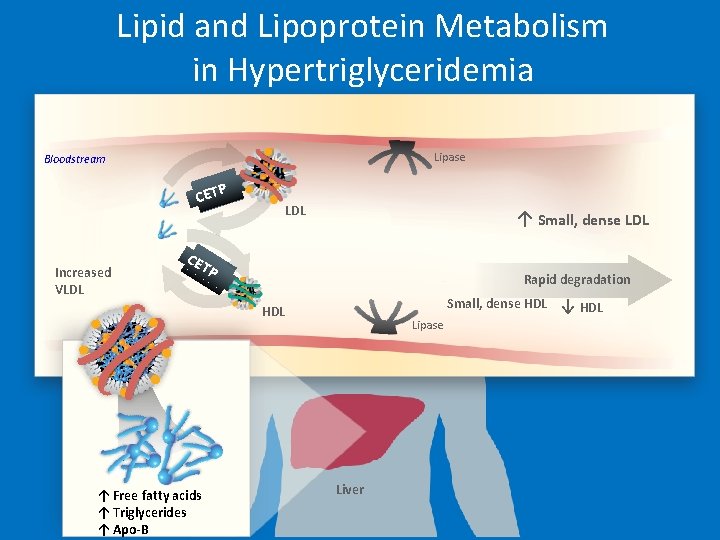 Lipid and Lipoprotein Metabolism in Hypertriglyceridemia Lipase Bloodstream CETP Increased VLDL ↑ Small, dense