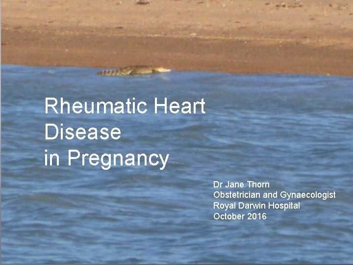 Rheumatic Heart Disease in Pregnancy Dr Jane Thorn Obstetrician and Gynaecologist Royal Darwin Hospital