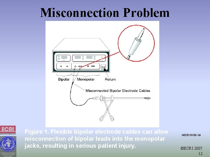 Misconnection Problem Figure 1. Flexible bipolar electrode cables can allow misconnection of bipolar leads