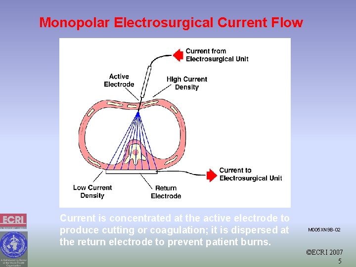 Monopolar Electrosurgical Current Flow Current is concentrated at the active electrode to produce cutting