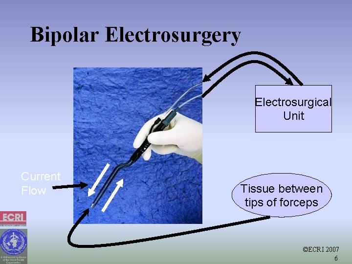 Bipolar Electrosurgery Electrosurgical Unit Current Flow Tissue between tips of forceps ©ECRI 2007 6